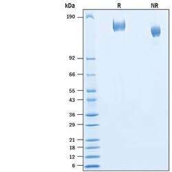R D Systems Recombinant SARS-CoV-2 B.1.351 Spike GCN4-IZ His Protein 100 &mu;g | Buy Online | R&amp;D Systems&trade; | Fisher Scientific