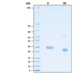 R&D Systems&trade;&nbsp;Recombinant SARS-CoV-2 F486I Spike RBD His-tag Protein