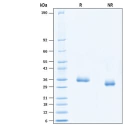 R&D Systems&trade;&nbsp;Recombinant SARS-CoV-2 E406W Spike RBD His-tag Protein