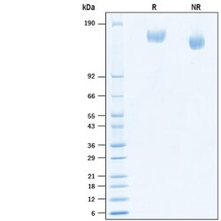 R D Systems Recombinant SARS-CoV-2 B.1.525 Spike GCN4-IZ His Protein 100 &mu;g | Buy Online | R&amp;D Systems&trade; | Fisher Scientific