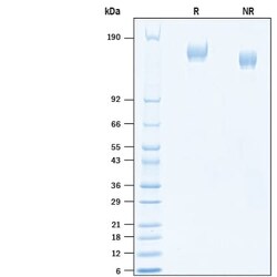 R&D Systems&trade;&nbsp;Recombinant SARS-CoV-2 B.1.1.7 Spike GCN4-IZ His Protein