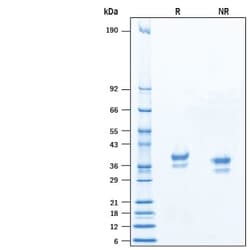 R&D Systems&trade;&nbsp;Recombinant Human VSIG3 His-tag Protein