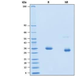 R&D Systems&trade;&nbsp;Recombinant SARS-CoV-2 K417E Spike RBD His-tag Protein