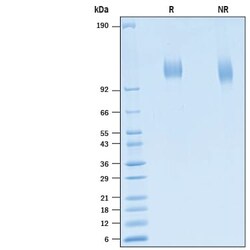 R&D Systems&trade;&nbsp;Recombinant SARS-CoV-2 B.1.2 S1 Subunit His-tag Protein