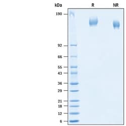 R D Systems Recombinant SARS-CoV-2 +E484K B.1.1.7 Spike GCN4-IZ Protein 100 &mu;g | Buy Online | R&amp;D Systems&trade; | Fisher Scientific