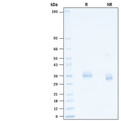 R D Systems Recombinant SARS-CoV-2 B.1.617.1 Spike RBD His Protein 100 &mu;g | Buy Online | R&amp;D Systems&trade; | Fisher Scientific