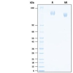 R D Systems Recombinant SARS-CoV-2 B.1.526 Spike GCN4-IZ His Protein 100 &mu;g | Buy Online | R&amp;D Systems&trade; | Fisher Scientific