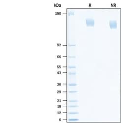 R D Systems Recombinant SARS-CoV-2 CAL.20C Spike GCN4-IZ His Protein 100 &mu;g | Buy Online | R&amp;D Systems&trade; | Fisher Scientific