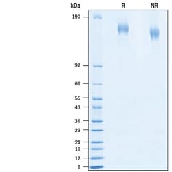 R&D Systems™ Recombinant SARS-CoV-2 D614G Spike (GCN4-IZ) His Protein