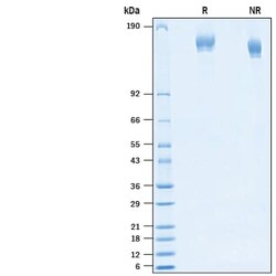 R D Systems Recombinant SARS-CoV-2 P.3 Spike (GCN4-IZ) His Protein 100 &mu;g | Buy Online | R&amp;D Systems&trade; | Fisher Scientific