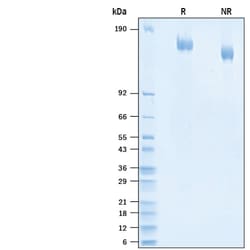 R&D Systems&trade;&nbsp;Recombinant SARS-CoV-2 A.23.1 Spike GCN4-IZ His Protein