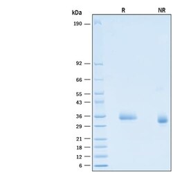 R D Systems Recombinant SARS-CoV-2 B.1.617.2 Spike RBD His Protein 100 &mu;g | Buy Online | R&amp;D Systems&trade; | Fisher Scientific