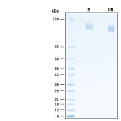 R&D Systems&trade;&nbsp;Recombinant SARS-CoV-2 B.1.1.519 Spike GCN4-IZ Protein
