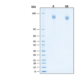 R D Systems Recombinant SARS-CoV-2 B.1.621 Spike GCN4-IZ His Protein 100 &mu;g | Buy Online | R&amp;D Systems&trade; | Fisher Scientific