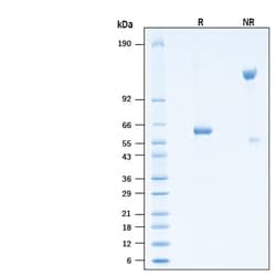 R D Systems Recombinant SARS-CoV-2 B.1.617.2 Spike RBD Fc Protein 100 &mu;g | Buy Online | R&amp;D Systems&trade; | Fisher Scientific