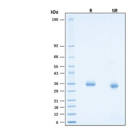 R D Systems Recombinant SARS-CoV-2 AY.1/AY.2 Spike RBD His Protein 100 &mu;g | Buy Online | R&amp;D Systems&trade; | Fisher Scientific