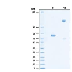 R&D Systems&trade;&nbsp;Recombinant SARS-CoV-2 AY.1/AY.2 Spike RBD Fc Protein