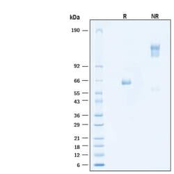 R D Systems Recombinant Human IL-2 R beta Fc Chimera Protein 50 &mu;g | Buy Online | R&amp;D Systems&trade; | Fisher Scientific