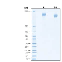 R&D Systems&trade;&nbsp;Recombinant SARS-CoV-2 B.1.617.2 Spike GCN4-IZ Protein