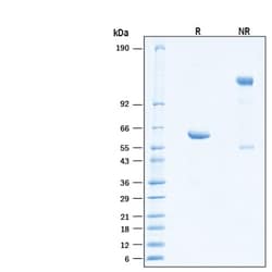 R D Systems Recombinant SARS-CoV-2 B.1.351 Spike RBD Fc Protein 100 &mu;g | Buy Online | R&amp;D Systems&trade; | Fisher Scientific