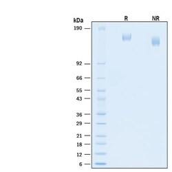 R&D Systems&trade;&nbsp;Recombinant SARS-CoV-2 B.1.617.2 Spike His-tag Protein
