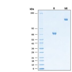 R D Systems Recombinant Mouse B7-H3 Fc Chimera Protein 50 &mu;g | Buy Online | R&amp;D Systems&trade; | Fisher Scientific