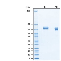 R&D Systems&trade;&nbsp;Recombinant Mouse FLRT1 His-tag Protein