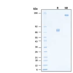 R D Systems Recombinant Human Mesothelin (aa 296-580) Fc Protein 50 &mu;g | Buy Online | R&amp;D Systems&trade; | Fisher Scientific