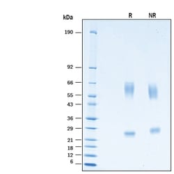 R&D Systems&trade;&nbsp;Recombinant Human GGT1 His-tag Protein