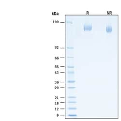 R&D Systems&trade;&nbsp;Recombinant SARS-CoV-2 B.1.617.1 Spike His-tag Protein