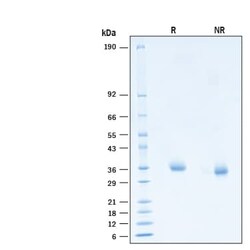 R&D Systems&trade;&nbsp;Recombinant SARS-CoV-2 B.1.617.2 G446V S RBD His Protein