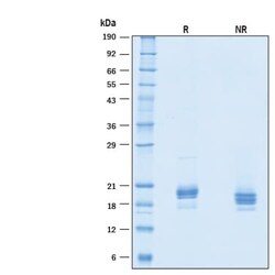 R D Systems Recombinant Human IFN-alpha-2A Protein, CF 10 &mu;g | Buy Online | R&amp;D Systems&trade; | Fisher Scientific