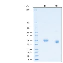 R&D Systems&trade;&nbsp;Recombinant SARS-CoV-2 C.1.2 Spike RBD His-tag Protein