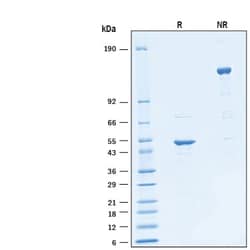 R&D Systems&trade;&nbsp;Recombinant SARS-CoV-2 B.1.617.2 N His-tag Protein
