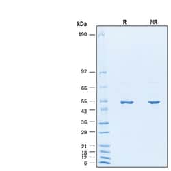 R&D Systems&trade;&nbsp;Recombinant SARS-CoV-2 B.1.2 N His-tag Protein