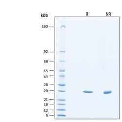 R&D Systems&trade;&nbsp;Recombinant Human TIGAR/C12orf5 His-tag Protein