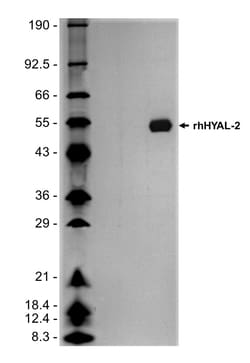 R&D Systems&trade;&nbsp;Recombinant Human Hyaluronidase 2/HYAL2 His-tag Protein