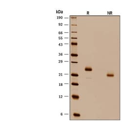R D Systems Recombinant Human IFN-alpha H2/IFNA14 Protein 10 &mu;g | Buy Online | R&amp;D Systems&trade; | Fisher Scientific