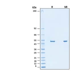 R&D Systems&trade;&nbsp;Recombinant SARS-CoV-2 Nucleocapsid His-tag Protein