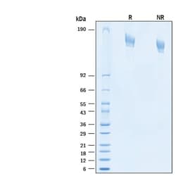 R&D Systems&trade;&nbsp;Recombinant SARS-CoV-2 P.1.8 Spike (GCN4-IZ) His Protein