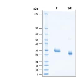 R&D Systems&trade;&nbsp;Recombinant SARS-CoV-2 B.1.630 Spike RBD His-tag Protein