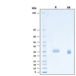 R&D Systems&trade;&nbsp;Recombinant SARS-CoV-2 B.1.1.529 S RBD His-tag Protein