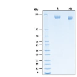 R&D Systems&trade;&nbsp;Recombinant SARS-CoV-2 B.1.1.529 S (GCN4-IZ) His Protein