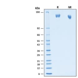 R D Systems Recombinant SARS-CoV-2 AY.4.2 S (GCN4-IZ) His Protein 100 &mu;g | Buy Online | R&amp;D Systems&trade; | Fisher Scientific
