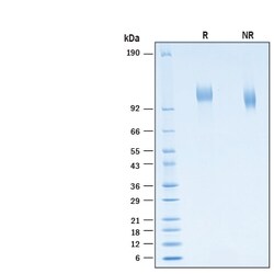 R&D Systems&trade;&nbsp;Recombinant SARS-CoV-2 B.1.1.529 S1 His-tag Protein