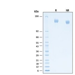 R D Systems Recombinant SARS-CoV-2 B.1.630 S (GCN4-IZ) His Protein, CF 100 &mu;g | Buy Online | R&amp;D Systems&trade; | Fisher Scientific