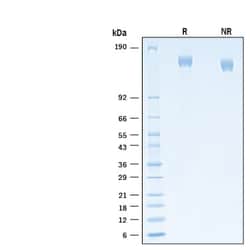 R&D Systems&trade;&nbsp;Recombinant SARS-CoV-2 B.1.640 Spike GCN4-IZ His Protein