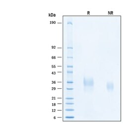 R D Systems Recombinant Human IL-9 Protein 100 &mu;g | Buy Online | R&amp;D Systems&trade; | Fisher Scientific