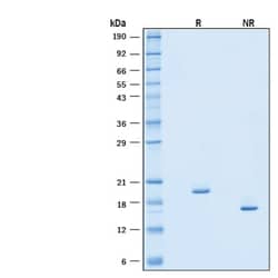 R&D Systems&trade;&nbsp;Recombinant Human IFN-alpha I/IFN17 Protein