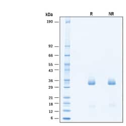 R D Systems Recombinant Human EBI3 Protein 50 &mu;g | Buy Online | R&amp;D Systems&trade; | Fisher Scientific